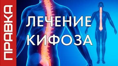 Альтернативные безопасные решения