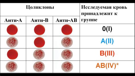 Диагноз Стадия 1а 2 кл группа