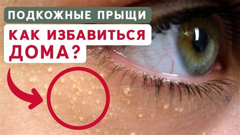 Значение глубины прыща