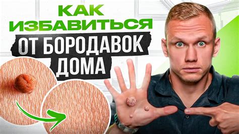 Избавляемся от рипплов