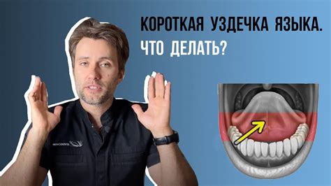 Когда следует подрезать уздечку