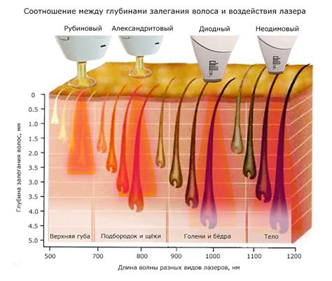 Лазерная печать: факты и мифы