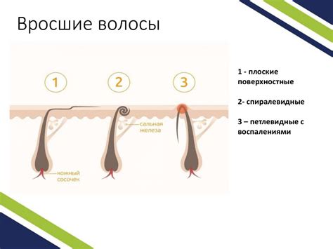Методы преодоления обламывания волосков при депиляции воском