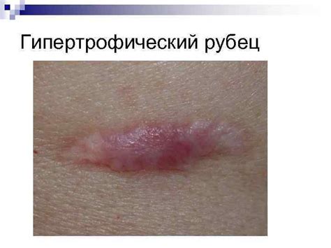Механическое повреждение кожуры