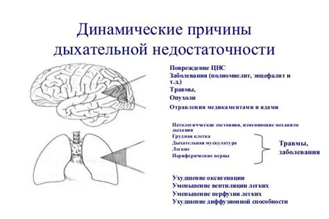 Нарушение дыхательной функции: основные причины гундоси