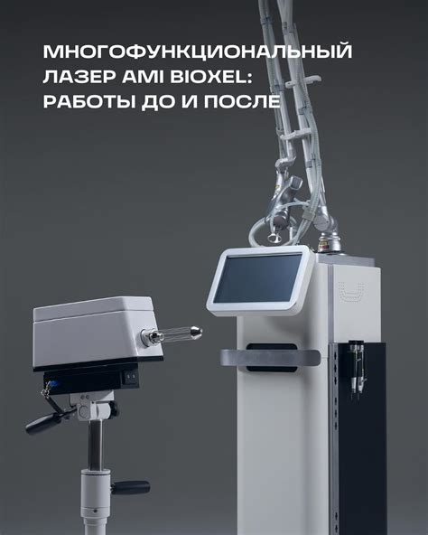 Описание технологии MST