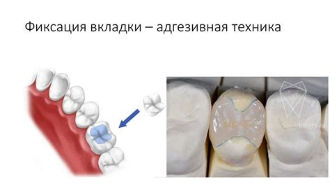 Особенности работы с дентальным страхованием в стоматологической практике