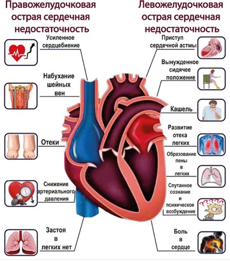 Польза бега при сердечной недостаточности