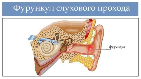 Последствия закупорки слухового прохода