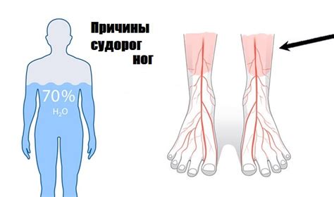 Почему возникают судороги ног ночью