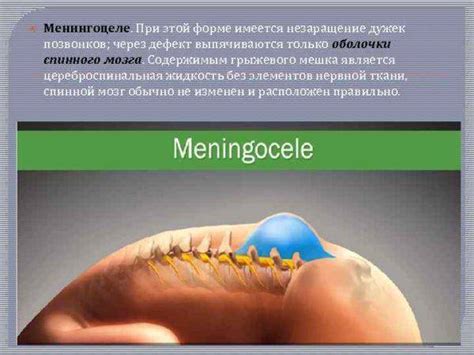 Причины возникновения шишки