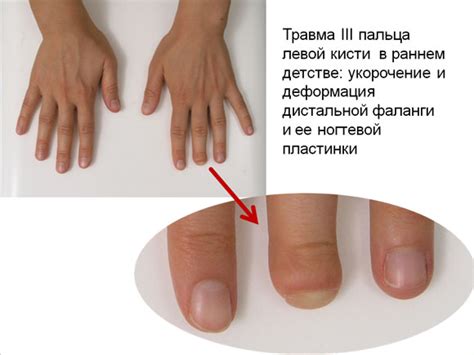 Причины немощных пальцев
