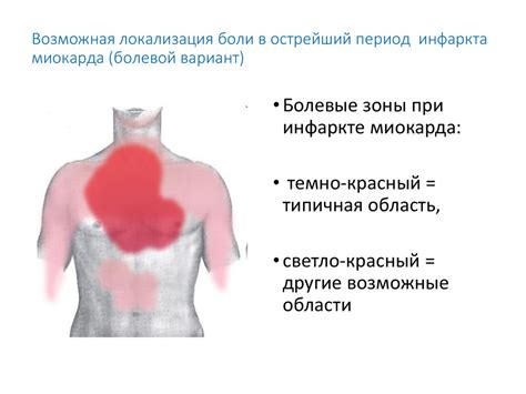 Проблема болей в грудной клетке