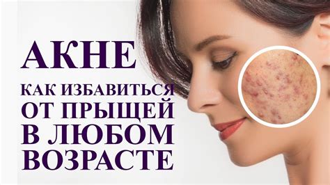 Проблема прыщей в возрасте: важное отклонение от нормы
