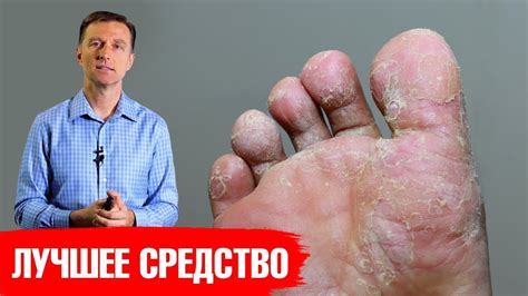 Профилактика грибка под полом