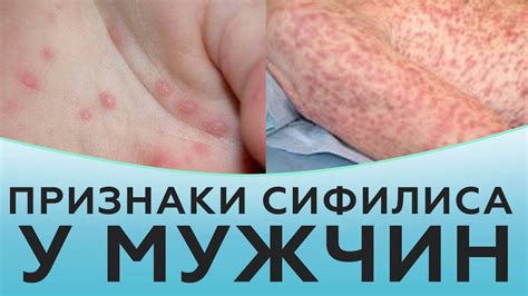 Проявления "ребячества" у парня
