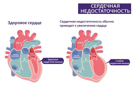 Рекомендации по занятию бегом при сердечной недостаточности