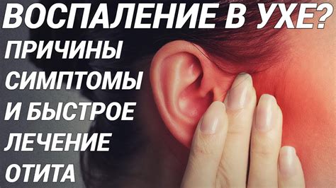 Сгорание левого уха