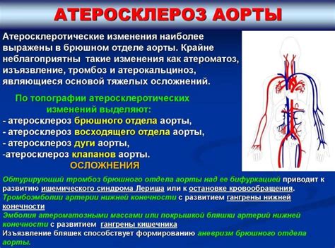 Серьезные симптомы атеросклероза аорты, которые необходимо учесть