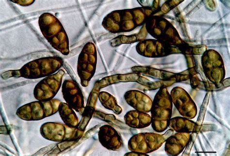 Симптомы грибка alternaria tenuis
