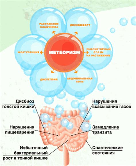 Способы уменьшить газообразование в желудке и кишечнике