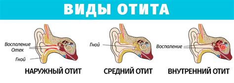 Укрепляйте здоровье ушей