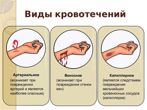 Шаг 2: Остановить кровотечение