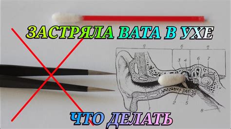 Быстрые и безопасные методы очистки уха от йода