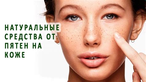 Натуральные средства от пятен на руках