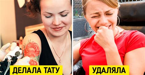 Профессиональное удаление татуировки от жвачки