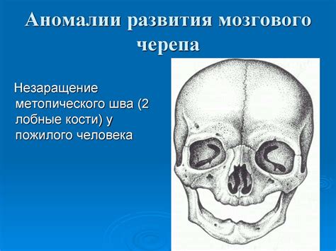 Учитывайте особенности кости